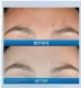 Resurfacing Retinol Serum – Advanced Skin Renewal Formula | Reduces Post-Acne Marks, Fine Lines & Wrinkles | Smooths & Revitalizes for Clear, Healthy-Looking Skin