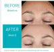 Resurfacing Retinol Serum – Advanced Skin Renewal Formula | Reduces Post-Acne Marks, Fine Lines & Wrinkles | Smooths & Revitalizes for Clear, Healthy-Looking Skin